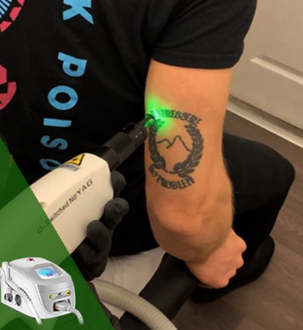 QS laser equipment 2 معدات الليزر QS 2