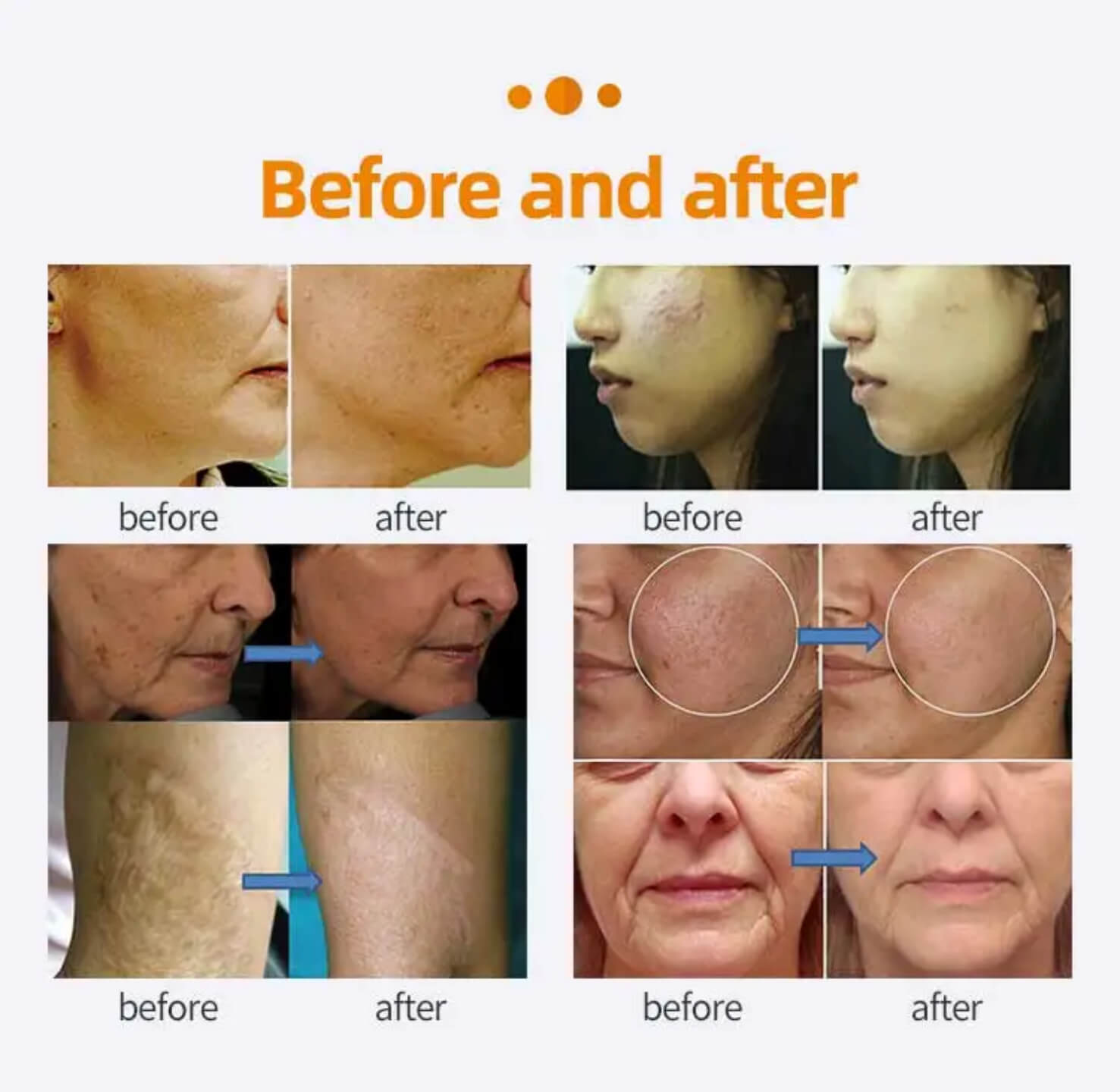 Before&After قبل وبعد