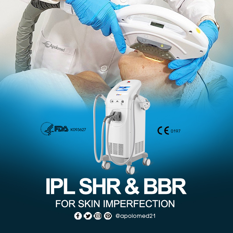 تقنية IPL SHR 660 3.9