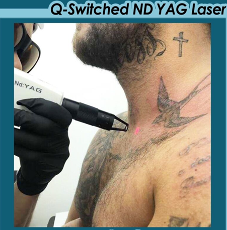 معدات الليزر QS 1