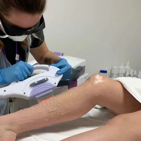 كم تكلف إزالة الشعر بالليزر حقًا