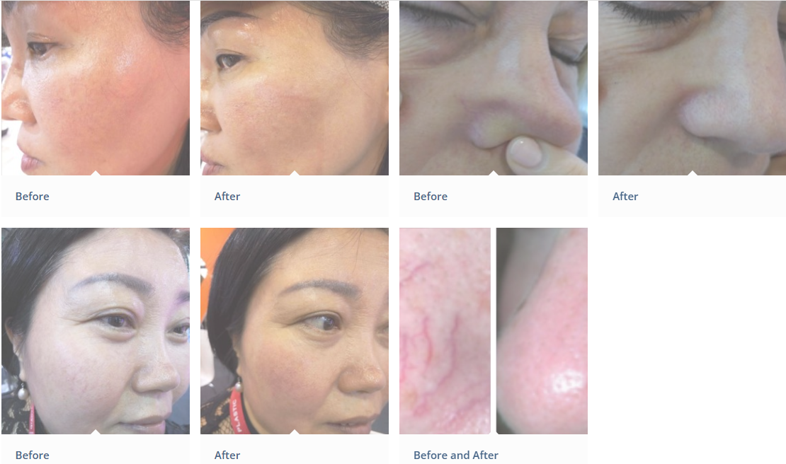 قبل وبعد الصورة